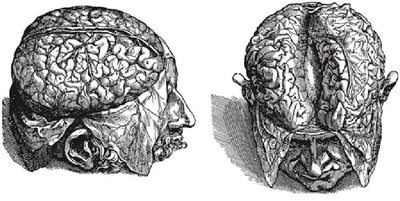113.jpg