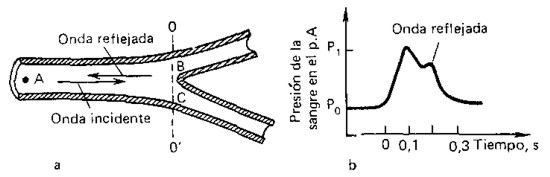 Surgimiento de la onda pulsátil reflejada en el lugar de la ramificación de la arteria: a, corte de la arteria ramificada; b, variación de la presión arterial cuando existe la onda reflejada