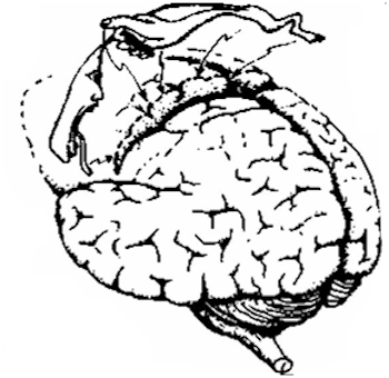 185.jpg