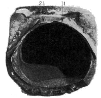 f132.jpg