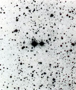 115.jpg